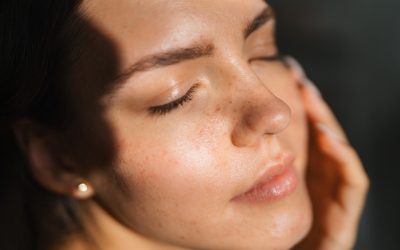 Happy Skin: de holistische aanpak voor een stralende huid